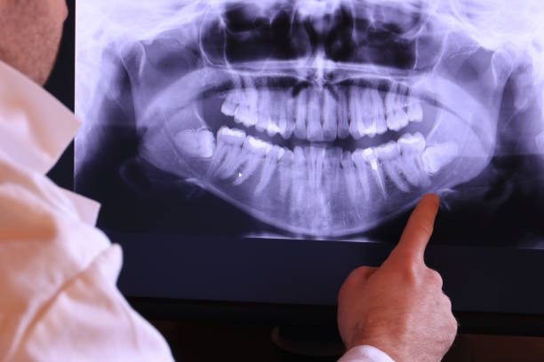 Best Emergency Tooth Extraction in Oakland, NE