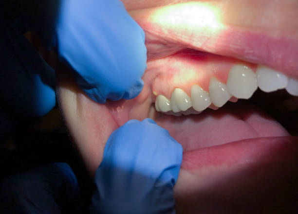 Professional Emergency Dentist in NE